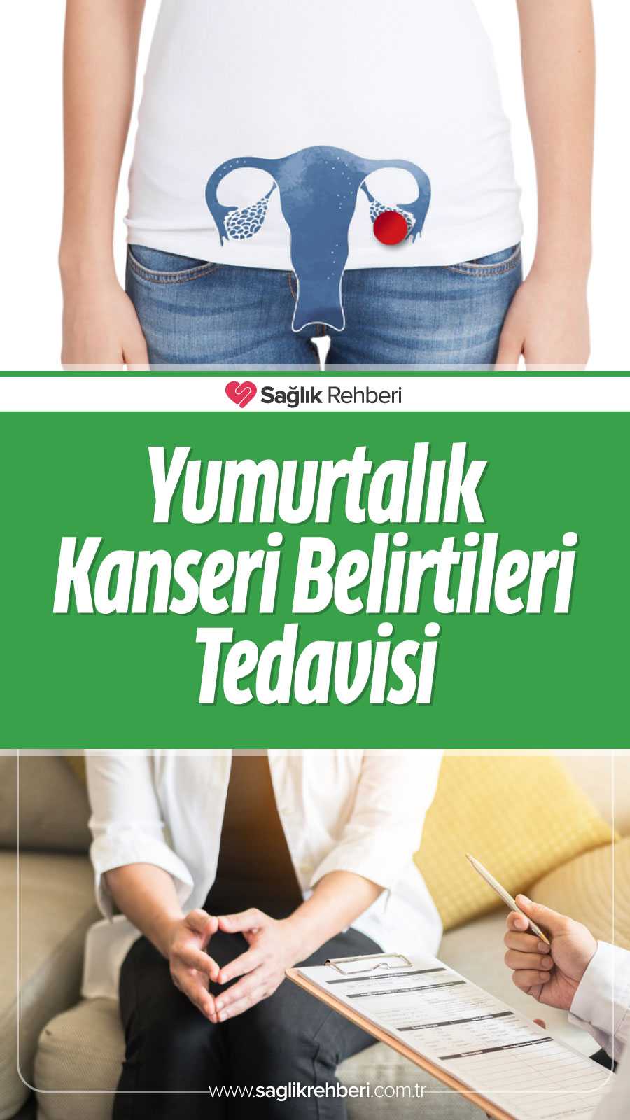 Over Yumurtalık Kanseri Nedir Belirtileri ve Tedavisi Sağlık Rehberi