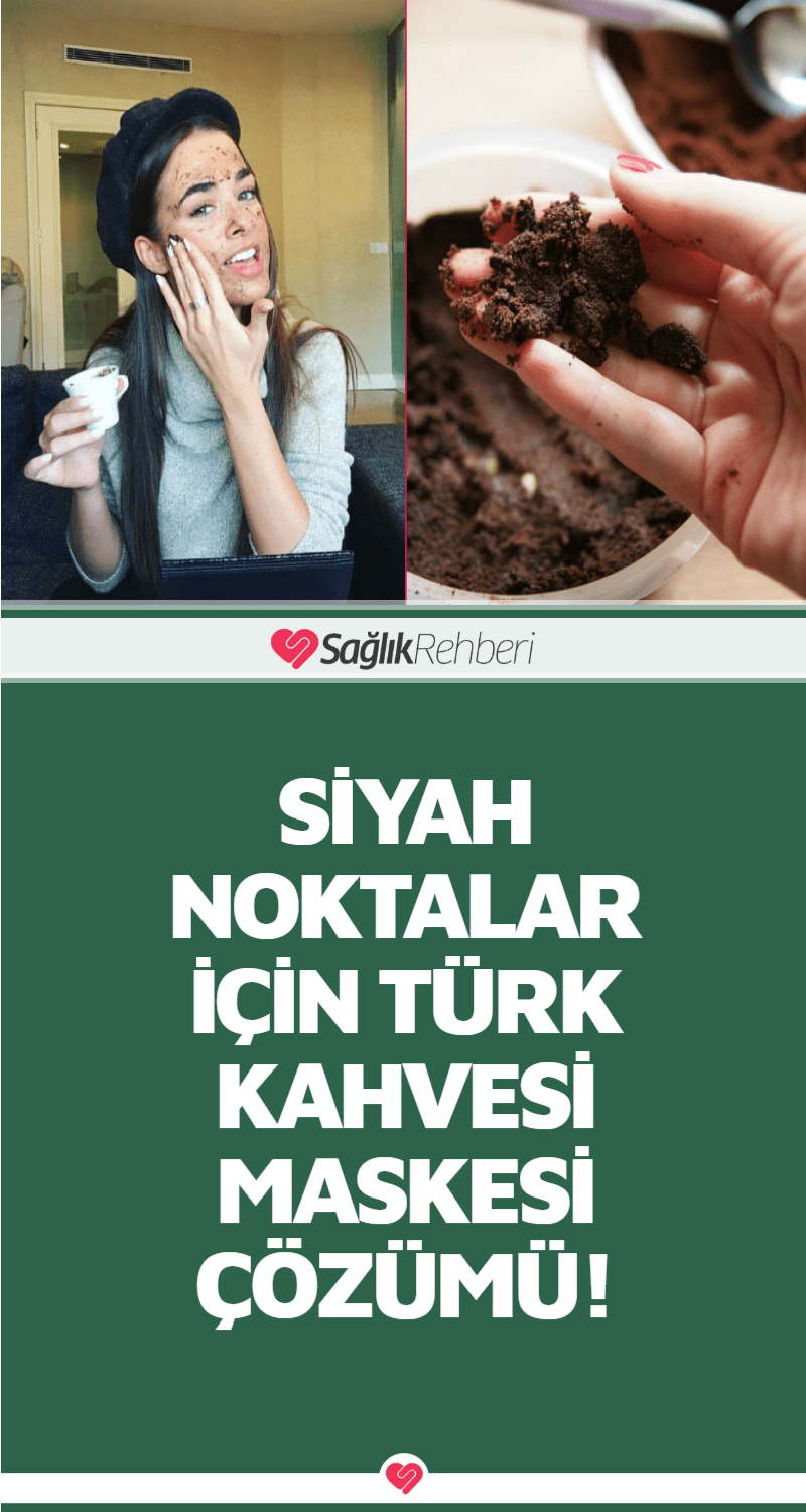 Siyah Noktalar İçin Türk Kahvesi Maskesi Çözümü!