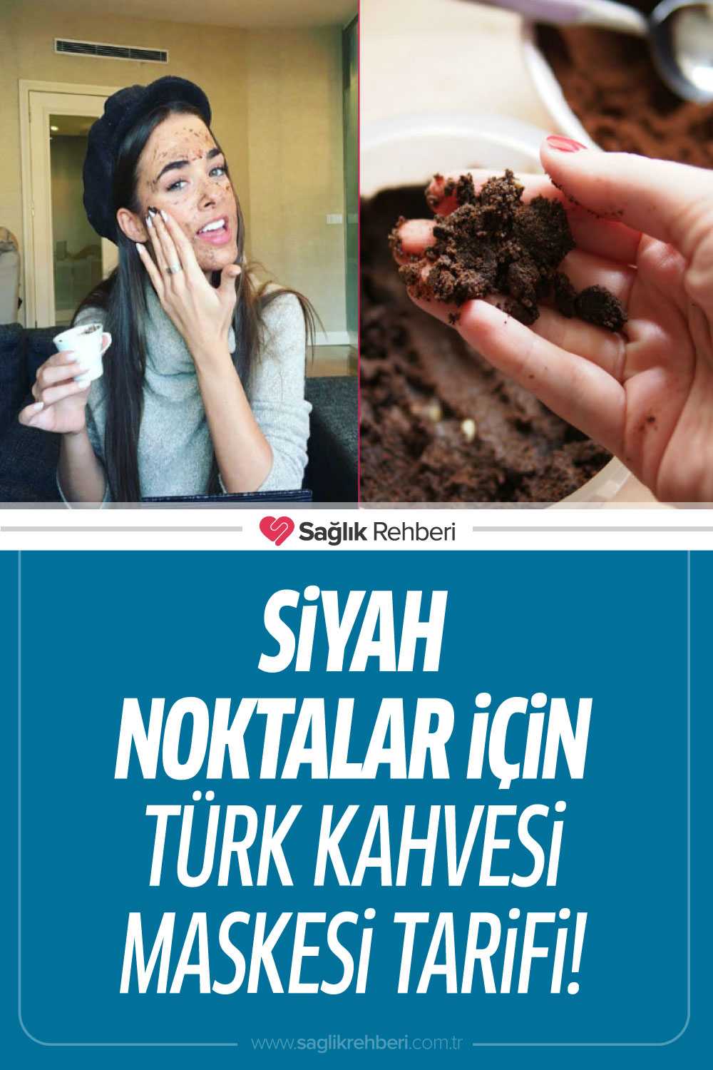 Siyah Noktalar İçin Türk Kahvesi Maskesi Çözümü!
