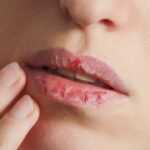 Ali-Ghahary-Dry-Chapped-Lips-660×330-1-1280×720